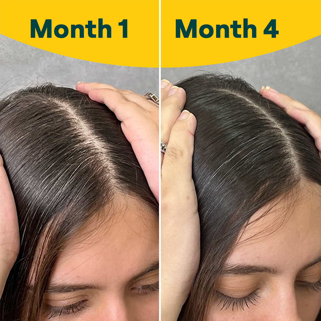 OZiva Hair Vitamins Supplements for Regrowth 100 Natural